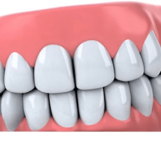 nettoyer son dentier